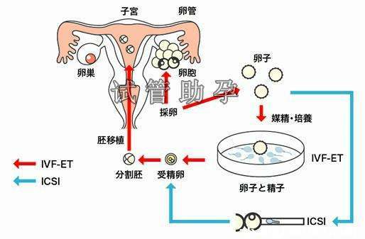 借卵生子有孕妈的遗传基因_遗传基因:借卵生子有孕妈”