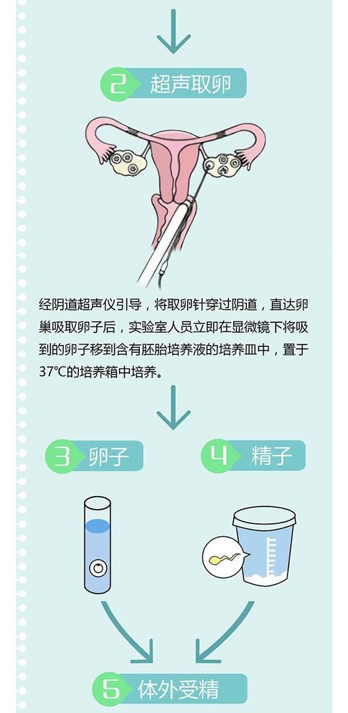 借卵试管代怀双胞胎流程【借卵试管代怀双胞胎流程详解】