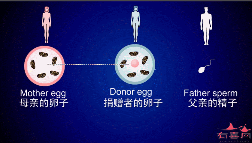 供卵试管代怀双胞胎零风险_零风险：供卵试管代怀双胞胎新选择